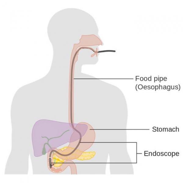 Pancreatic Cancer