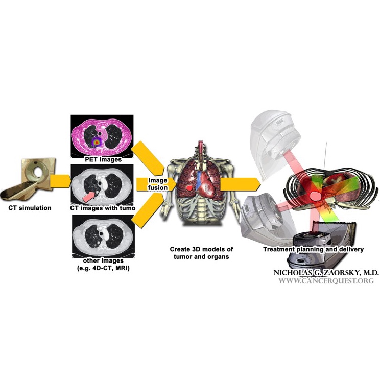 What to expect during radiation therapy