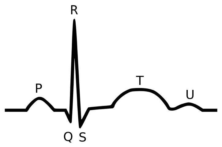 The first electrocardiogram (ECG or EKG) reading was taken by Willem Einthoven using a string galvanometer that he designed himself.1 ECGs can be used to diagnose some cases of kidney (renal) cancer.1Barold, S.S. "Willem Einthoven and the Birth of Clinical Electrocardiography a Hundred Years Ago." Cardiac Electrophysiology Review. 7 (2003): 99-104. [PUBMED]      
