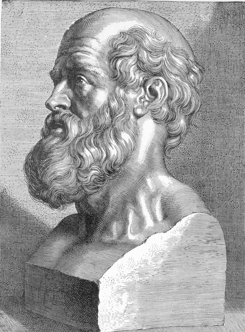 Known today as the father of medicine, proposed the Humoral Theory of Medicine, which states that the body is composed of four fluids, or humors: blood, phlegm, yellow bile, and black bile. Any imbalance of these fluids was thought to cause disease. He attributed cancer to an excess of black bile. Hippocrates was the first to use the words "carcinos" and "carcinoma" to describe tumors, and hence the term "cancer" was coined. "Cancer" is derived from the Greek word "karkinos," or crab, which is thought to reference the appearance of blood vessels on tumors resembling a crab's claws reaching out. He believed that it was best to leave cancer alone because those who got treatment didn't survive as long.1231Morton, Leslie T., and Moore, Robert J. A Chronology of Medicine and Related Sciences. Aldershot, England: Scholar Press, 1997                      2The American Cancer Society Inc., "The History of Cancer." 25 Mar. 2002. 13-17 Accessed October 2010 [http://www.cancer.org/Cancer/CancerBasics/TheHistoryofCancer/the-history-of-cancer-cancer-causes-theories-throughout-history]                      3Udwadia, Farokh Erach. Man and Medicine: A History. Oxford: Oxford University Press, 2000.      