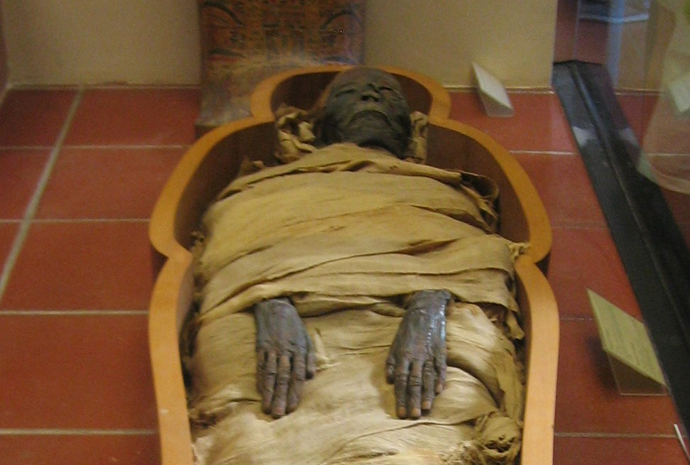 Signs of cancer are found on the bones of mummies from ancient Egypt and Peru dating back as far as 3000 BC. 1The Edwin Smith Papyrus, which is the oldest written description of cancer known to exist, describes eight cases of breast tumors or ulcers in Egypt that were treated with cauterization. However, the document also states that there is no treatment for cancer. The original document, written in 3000 BC, was acquired in 1862 by Edwin Smith at Luxor, Egypt.234  1Britannica Online. Encyclopedia Britannica. Accessed 13-17 June. 2005 [http://www.eb.com]                                2Morton, Leslie T., and Moore, Robert J. A Chronology of Medicine and Related Sciences. Aldershot, England: Scholar Press, 1997                                3The American Cancer Society Inc., "The History of Cancer." 25 Mar. 2002. 13-17 Accessed October 2010 [http://www.cancer.org/Cancer/CancerBasics/TheHistoryofCancer/the-history-of-cancer-cancer-causes-theories-throughout-history]                                4Udwadia, Farokh Erach. Man and Medicine: A History. Oxford: Oxford University Press, 2000.            