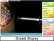 Screenshot of the breast biopsy module