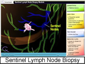 Screenshot of the sentinel lymph node biopsy module