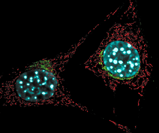 Las células y la estructura celular | CancerQuest