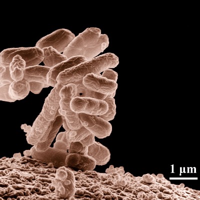 electron micrograph of rod-shaped bacteria