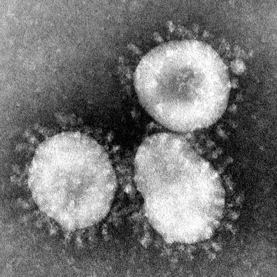 electron microscopic image of coronaviruses
