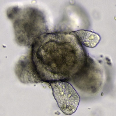 intestinal organoid