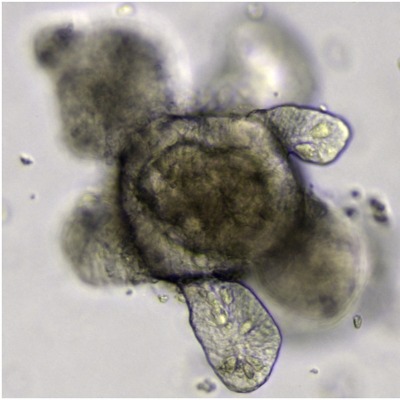 intestinal organoid grown from stem cells