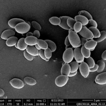 stock image of gut bacteria electron micrograph
