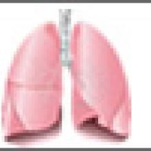 Key factor in lung cancer metastasis identified.
